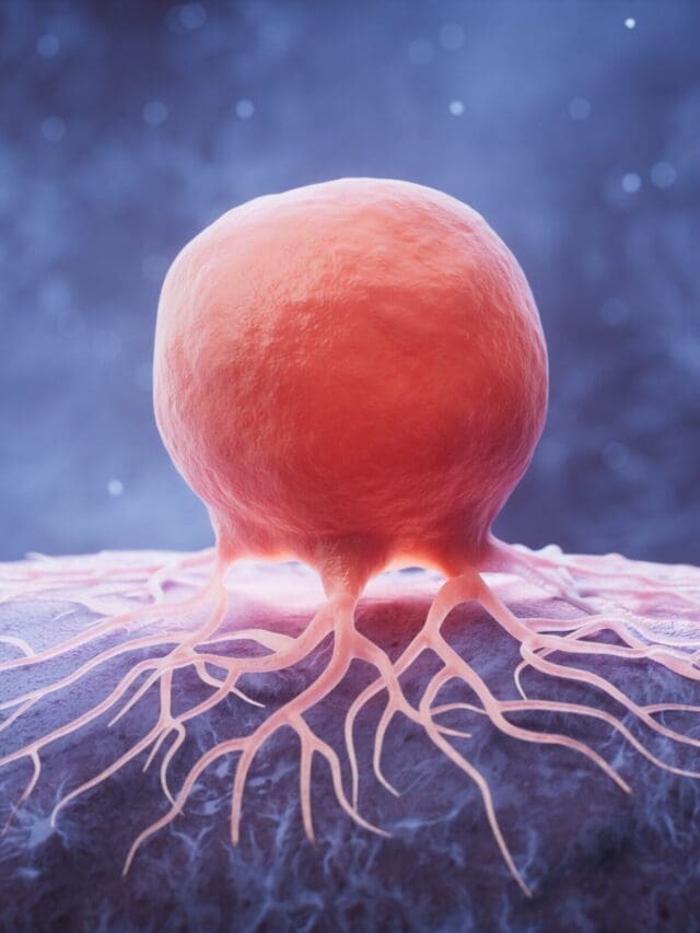 THE HARDEST CANCERS TO DETECT